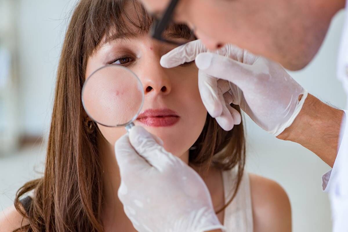 چه زمانی باید به دکتر پوست و مو مراجعه کنیم؟ چه زمانی باید به دکتر پوست و مو مراجعه کنیم؟