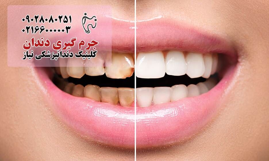 مراقبتهای دندانپزشکی که باید قبل از ۴۰ سالگی انجام دهید مراقبتهای دندانپزشکی که باید قبل از ۴۰ سالگی انجام دهید