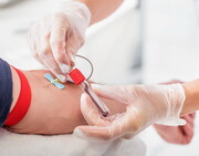 نگاهی به آمار اهدای خون در ۹ ماهه نخست ۱۴۰۰