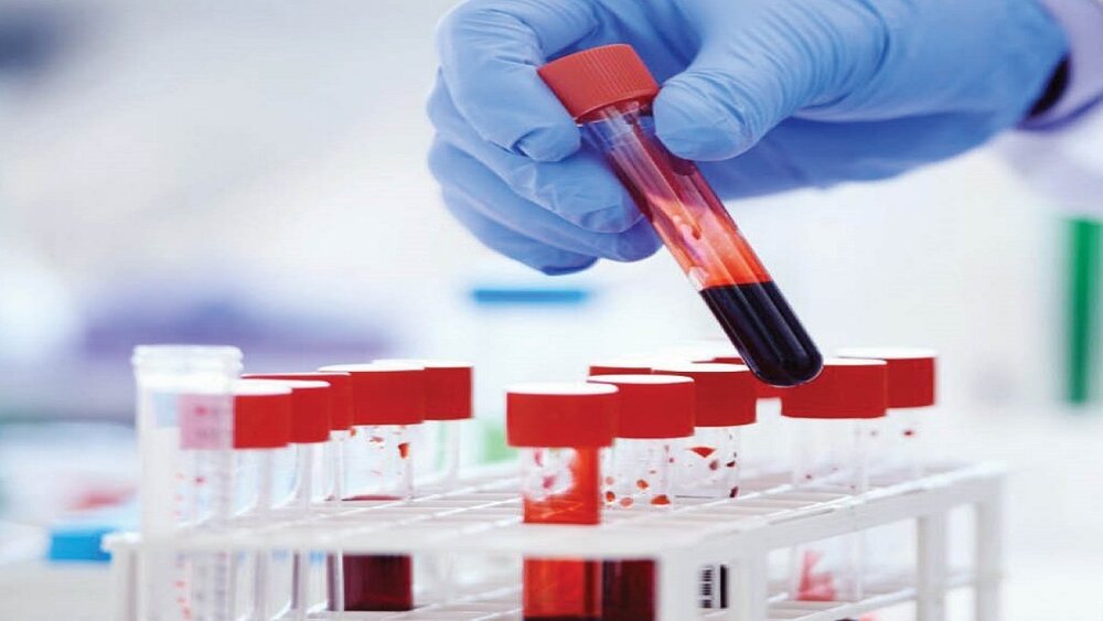 آزمایش ساده خون که نشان میدهد چه کسانی عمر طولانی‌تری خواهند داشت