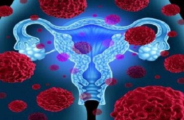 ویروس HPV؛ قاتل خاموش سرطان دهانه رحم در زنان