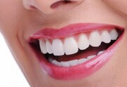 معرفی روش‌های درمانی و زیبایی دندانپزشکی