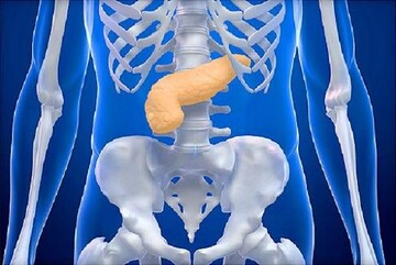 محافظت از لوزالمعده در برابر دیابت: پیوند شگفت‌انگیز آهن و انسولین