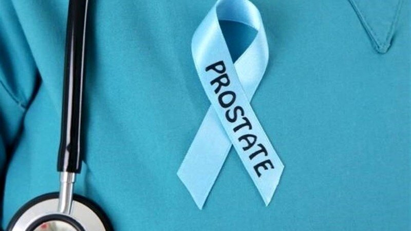 شایعترین سرطان در مردان ایرانی شایعترین سرطان در مردان ایرانی