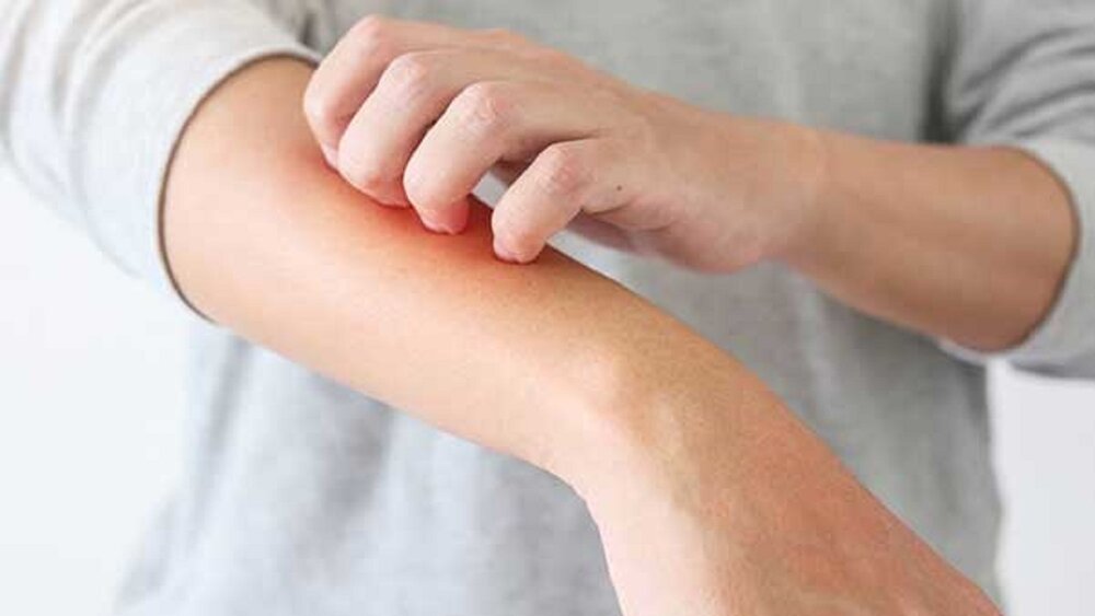 ۷ نشانه مقاومت بدن به انسولین در پوست ۷ نشانه مقاومت بدن به انسولین در پوست