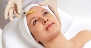 پلاسمادرمانی برای پوست صورت + کاربردها و مضرات
