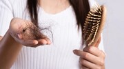 چه چیزی باعث ریزش مو در زنان می شود؟