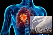 تاثیر آلودگی هوا بر سرطان ریه را جدی بگیریم!