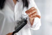 علت ریزش مو در بهبودیافتگان کرونا چیست؟