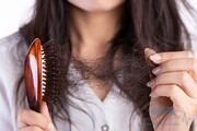 ریزش موی زنان در دوران یائسگی شایع است