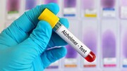 تشخیص آلزایمر از طریق نوعی آزمایش خون