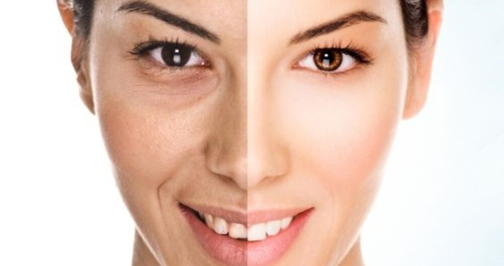 دلایل عجیبی که پوستتان را زودتر پیر میکنند دلایل عجیبی که پوستتان را زودتر پیر میکنند