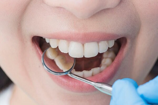 خوردن آبلیمو به صورت ناشتا چه خطری برای دندان دارد؟