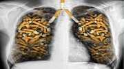 سلامت مردم مهم‌تر است یا اشتغال در صنعت دخانیات؟