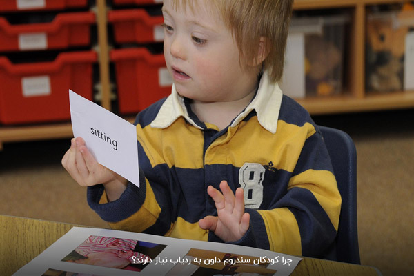 ردیاب افراد سندروم داون