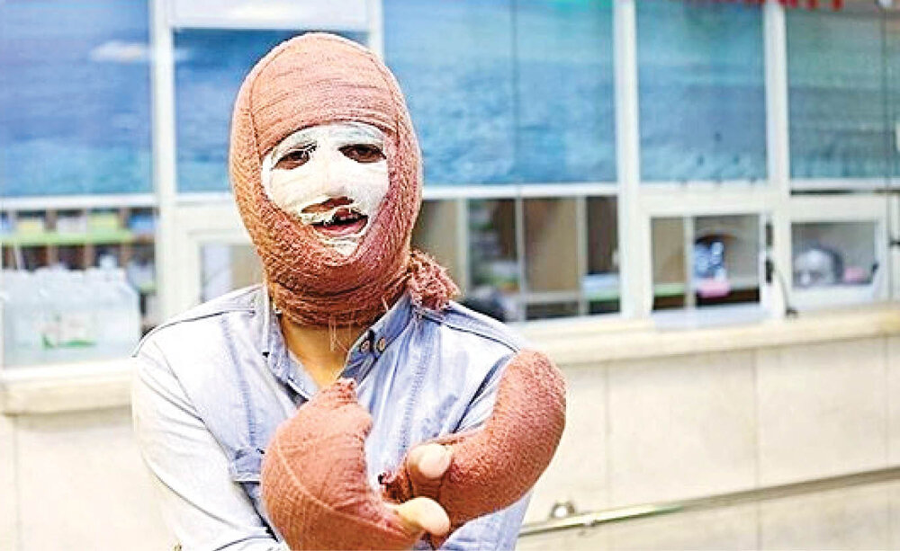 8جان پای انفجار ترقه 8جان پای انفجار ترقه