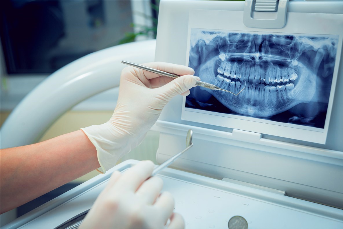 از جمله خدمات دندانپزشک خوب، بررسی اسکن دندان است.