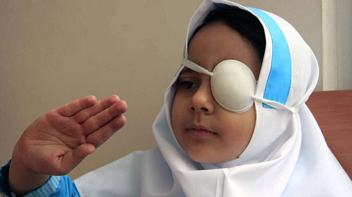 شناسایی کودکان دچار “تنبلی چشم” با غربالگری/پرداخت کمک هزینه درمان به خانوارهای نیازمند