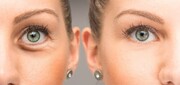 10 نکته مهم برای آرایش چشم های ریز و گود