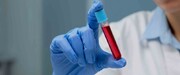 بالا بودن گلبول قرمز خون یا RBC در آزمایش خون چه عوارضی دارد؟