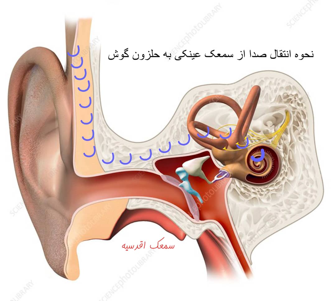 سمعک عینکی یا نامرئی؟