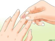 توصیه‌هایی برای درمان تاول پوستی
