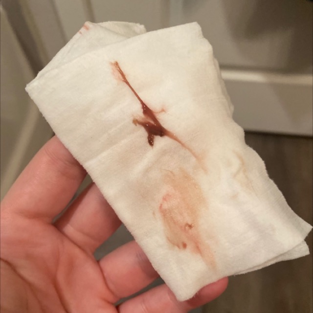 عکس لکه بینی در بارداری