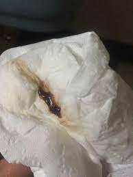 عکس لکه بینی در بارداری