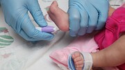 جزئیات غربالگری کم‌کاری تیروئید در نوزادان / افزایش اختلالات تیروئیدی با ابتلا به کرونا
