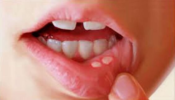درد زبان نشانه ی چیست؟