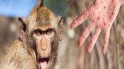 به‌ روز رسانی دستورالعمل متخصصان آمریکایی برای مهار آبله میمونی