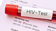 بهترین زمان برای آزمایش HIV چند ماه بعد از رابطه جنسی می باشد؟