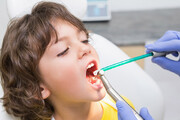 دو بیماری مهم دهان و دندان/انتقال آلودگی میکروبی از مادر به نوزاد