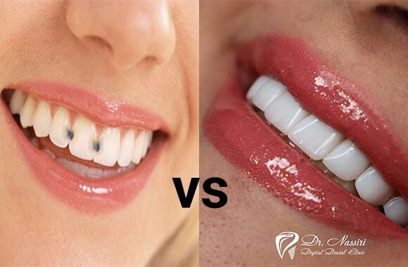 تفاوت های خدمات دندانپزشکی زیبایی و ترمیمی

