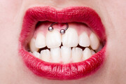 پیرسینگ زبان و دهان بسیار خطرناک است