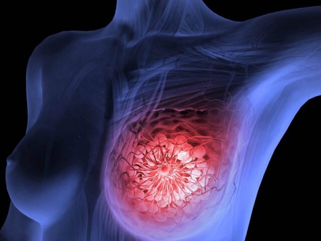 روند پیشرفت سرطان پستان در شب سریع تر است
