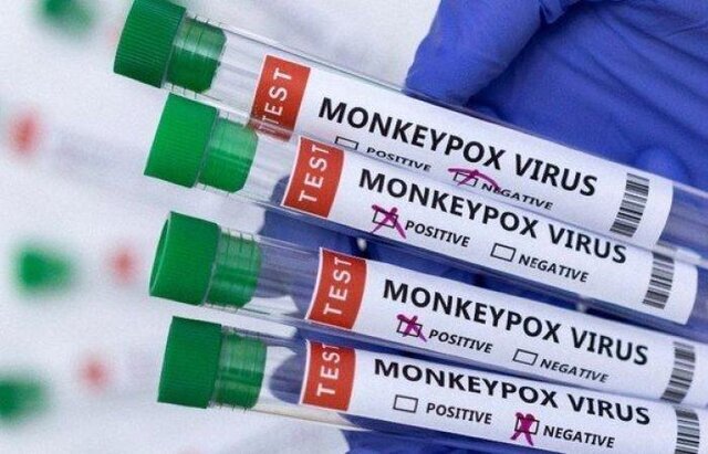 ویروس آبله میمون ۵۰ تنوع ژنتیکی ایجاد کرده است