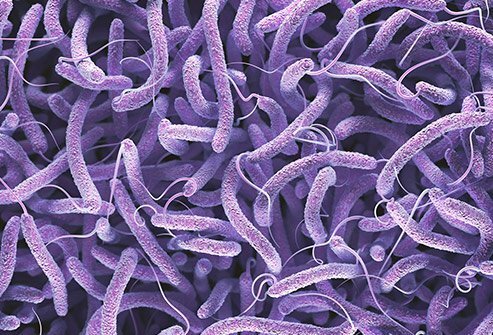 علائم بیماری وبا و راهکارهای درمان آن چیست؟