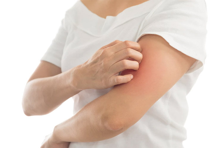 چرا خاراندن محل خارش لذت بخش است؟ چرا خاراندن محل خارش لذت بخش است؟