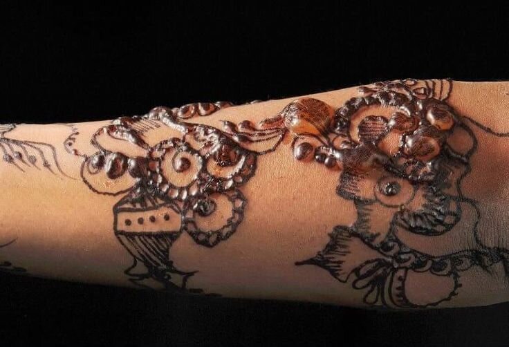 از عوارض تاتو چه میدانید؟ از عوارض تاتو چه میدانید؟