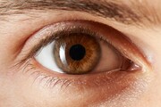 بیماری های شبکیه چشم به راحتی قابل تشخیص نیست