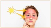 چند ماده غذایی موثر برای جلوگیری از آفتاب سوختگی