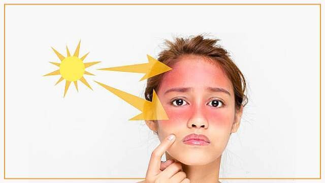 ریسک آفتاب سوختگی با مصرف برخی داروها بیشتر می شود