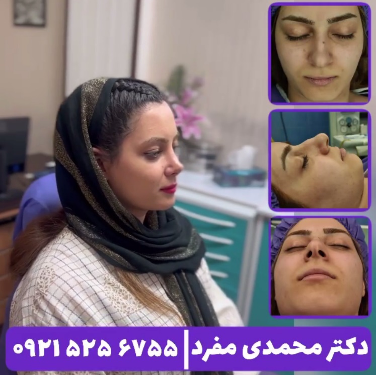 جراحی زیبایی بینی