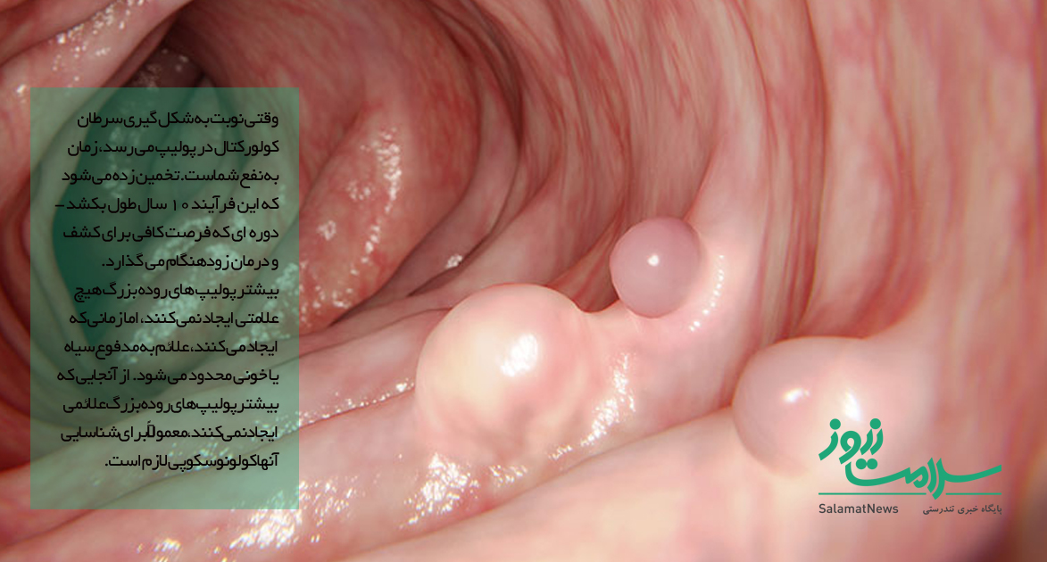 آیا سرطان روده درمان دارد؟