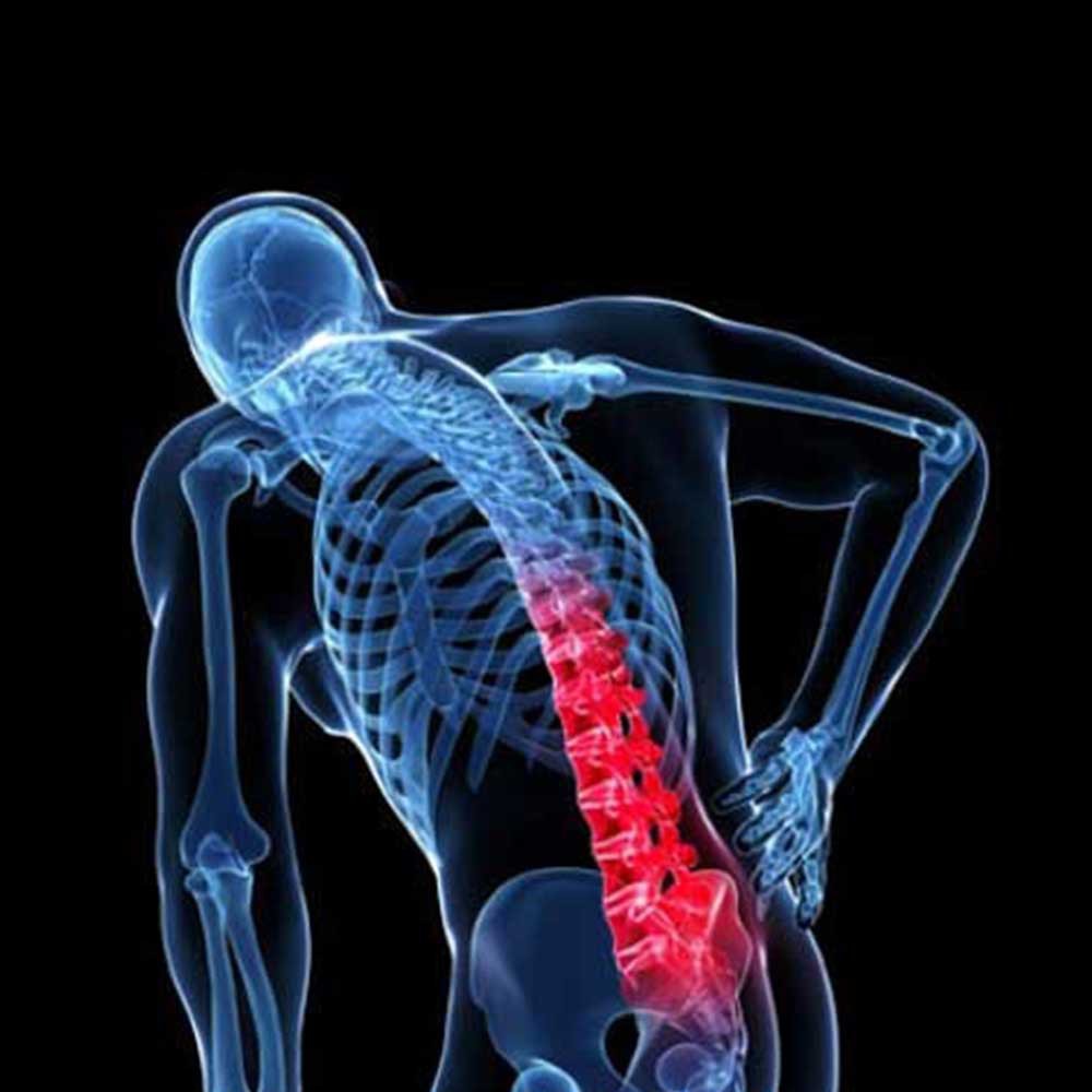 با کمر درد خداحافظی کنید