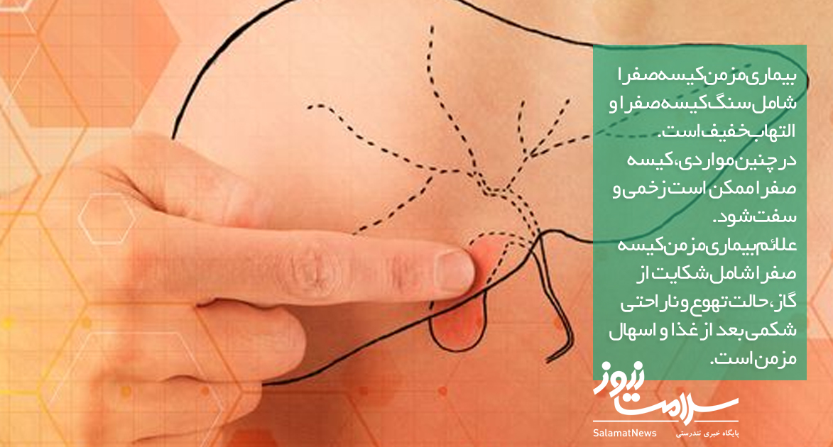 کیسه صفرا کجاست و چکار میکند؟