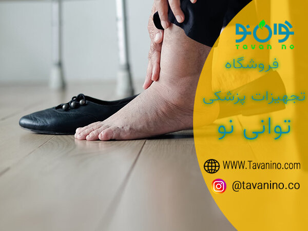 فروش عجیب جوراب واریس و ساپورت های طبی در توانی نو فروش عجیب جوراب واریس و ساپورت های طبی در توانی نو