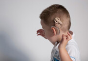 انجام بیش از ۱۴ هزار عمل کاشت حلزون شنوایی طی ۳۰ سال