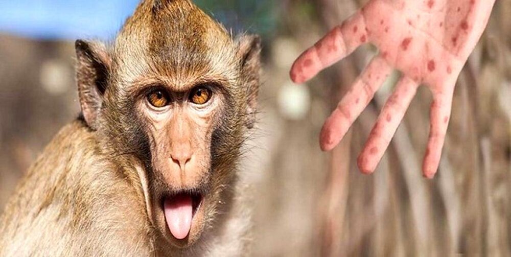 ژنتیک غیر متعارف در ویروس آبله میمون شناسایی شد
